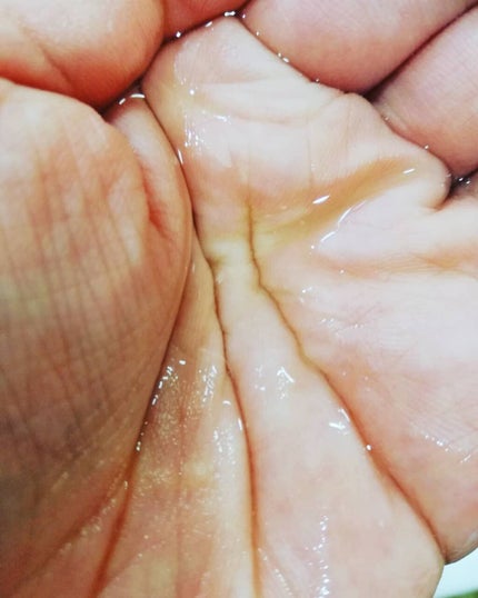 ヘッドスパセブン トリートメント/ヘッドスパセブン/頭皮トリートメントを使ったクチコミ(3枚目)