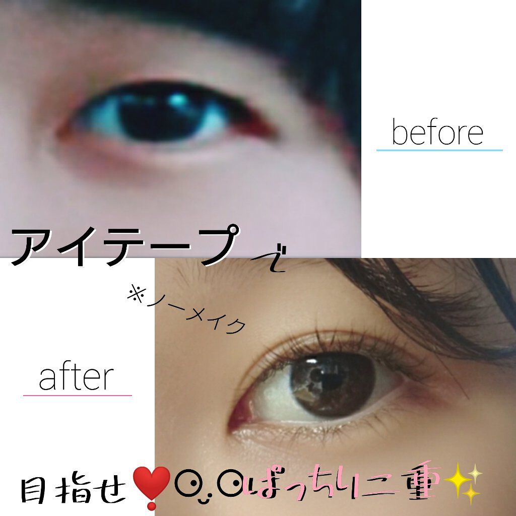 のびるアイテープ/セリア/二重まぶた用アイテムを使ったクチコミ（1枚目）