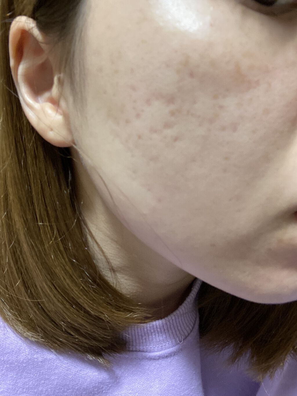 モイスチャー リッチローション(とてもしっとり)/アルージェ/化粧水を使ったクチコミ（2枚目）