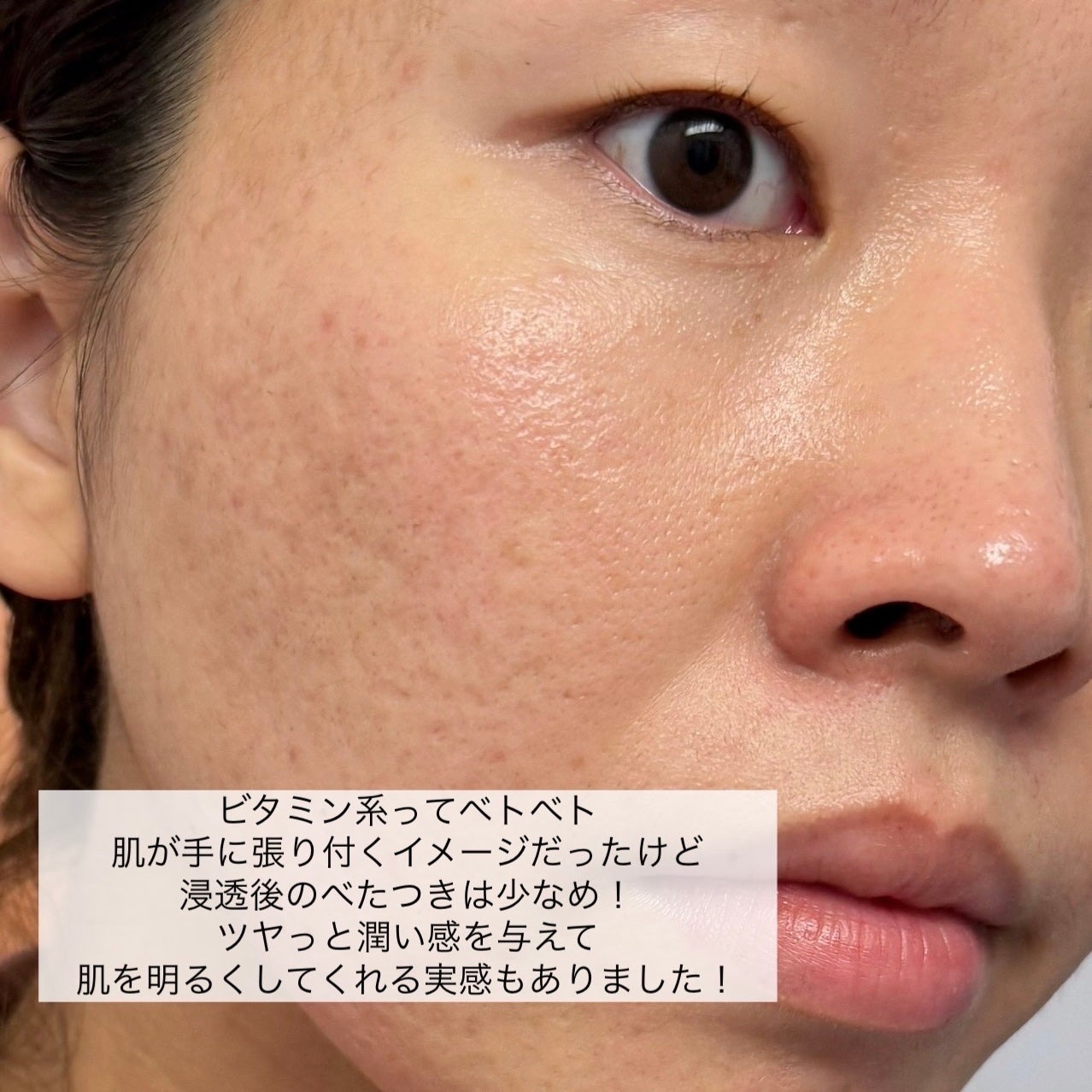 N organic Basic コンディショニング VCエッセンス/N organic/美容液を使ったクチコミ(5枚目)