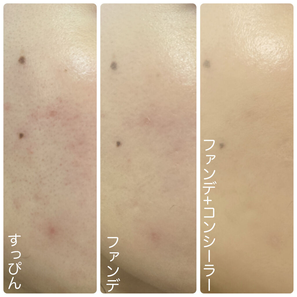 フィットミー コンシーラー/MAYBELLINE NEW YORK/リキッドコンシーラーを使ったクチコミ（3枚目）