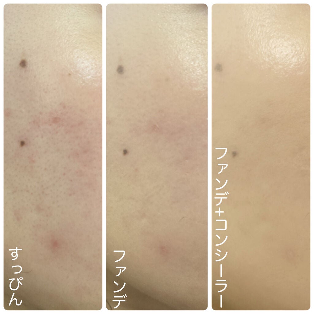 ãã£ããã㌠ã³ã³ã·ãŒã©ãŒ/MAYBELLINE NEW YORK/ãªãããã³ã³ã·ãŒã©ãŒã䜿ã£ãã¯ãã³ãïŒ3æç®ïŒ