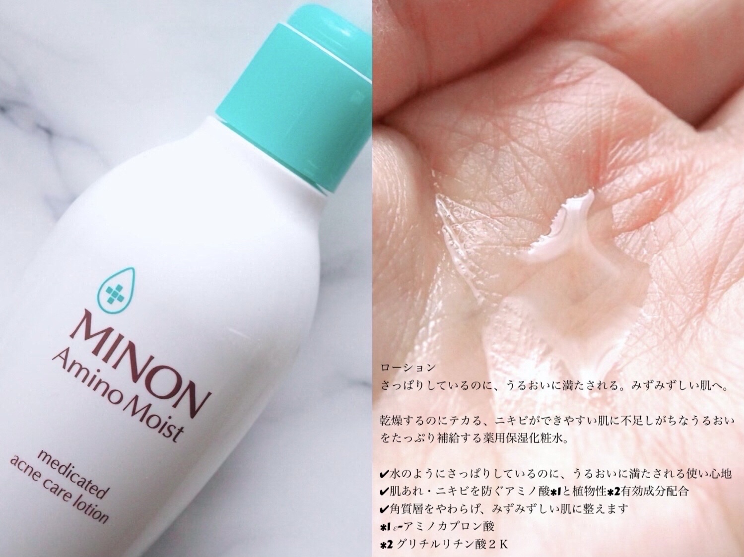 ミノン アミノモイスト 薬用アクネケア ローション/ミノン/化粧水を使ったクチコミ（3枚目）