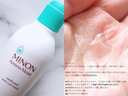 ミノン アミノモイスト 薬用アクネケア ローション/ミノン/化粧水を使ったクチコミ(3枚目)