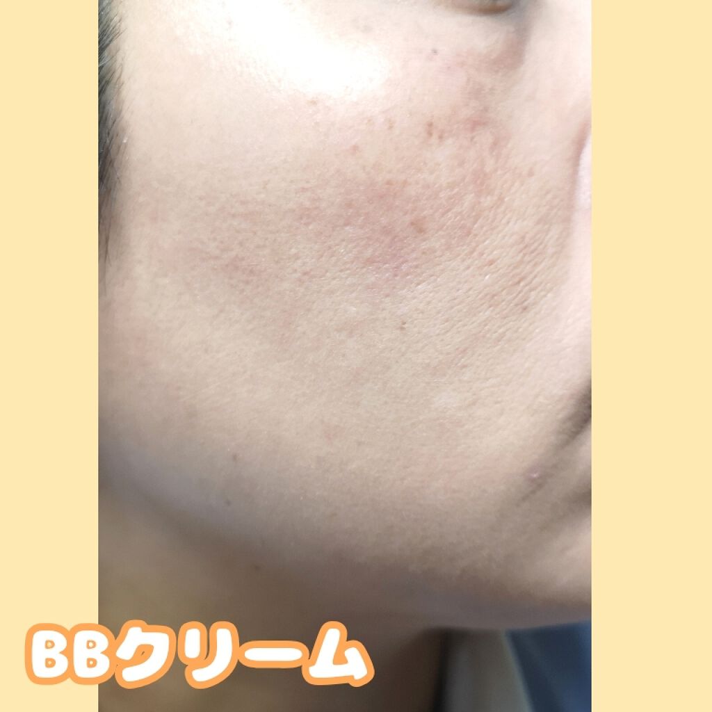 ホワイトニングクリアエマルジョン/d プログラム/乳液を使ったクチコミ（3枚目）