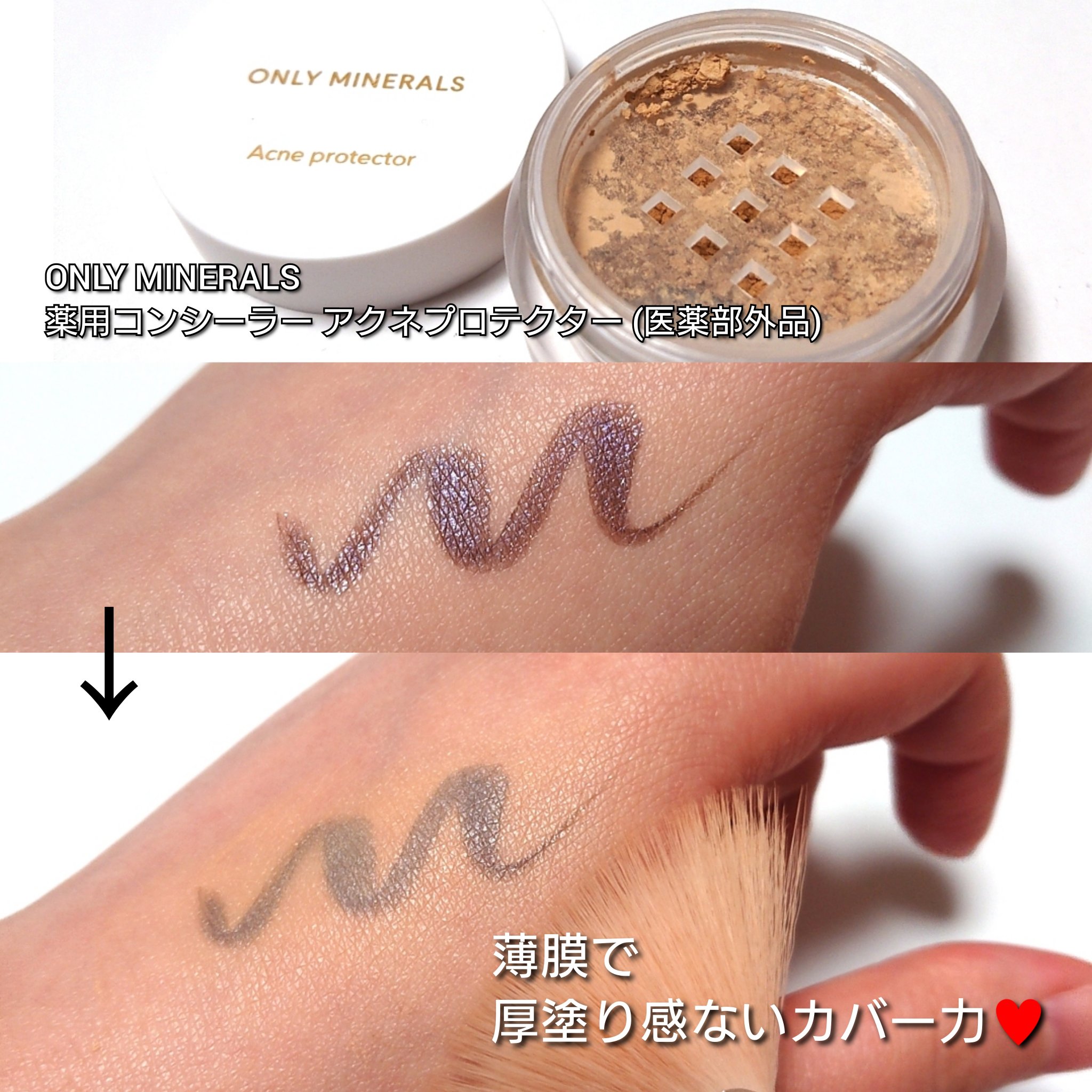薬用コンシーラー アクネプロテクター/ONLY MINERALS/パウダーコンシーラーを使ったクチコミ（3枚目）