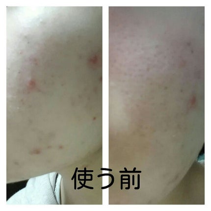 銀麦 on LIPS 「今回は株式会社イーズ・インターナショナルさんの「夜だけ美容断食..」(2枚目)