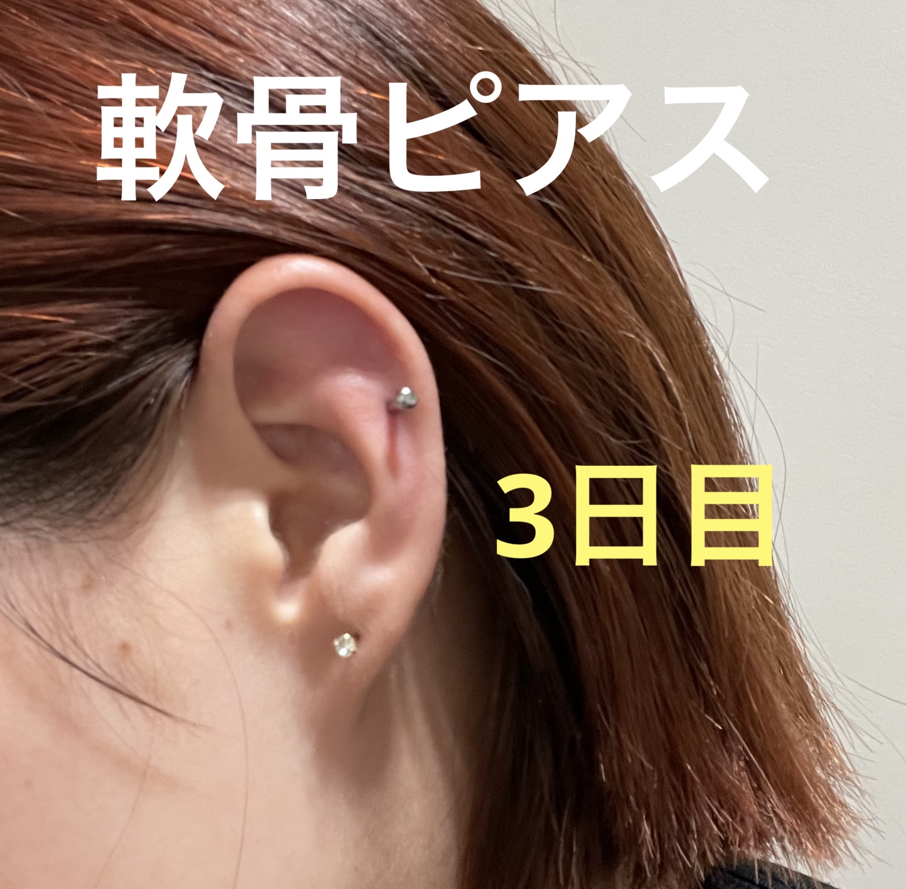 瞬間ピアッサー Q66/ヒーロー /その他を使ったクチコミ（1枚目）