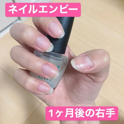 ネイルエンビー/O・P・I/ネイルオイル・トリートメントを使ったクチコミ(4枚目)