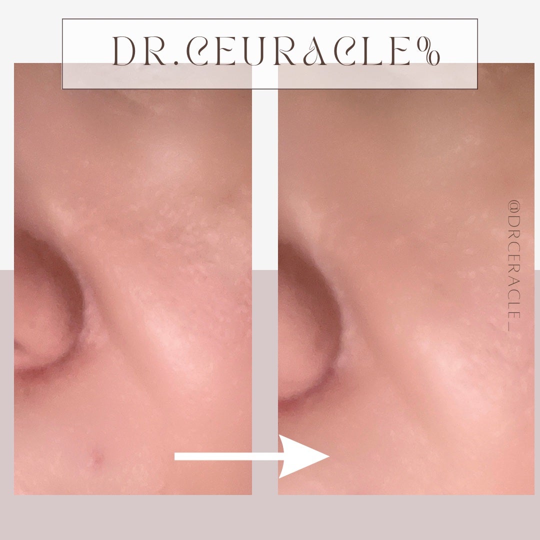 Pure VC Mellight Cream/Dr.Ceuracle/フェイスクリームを使ったクチコミ(6枚目)