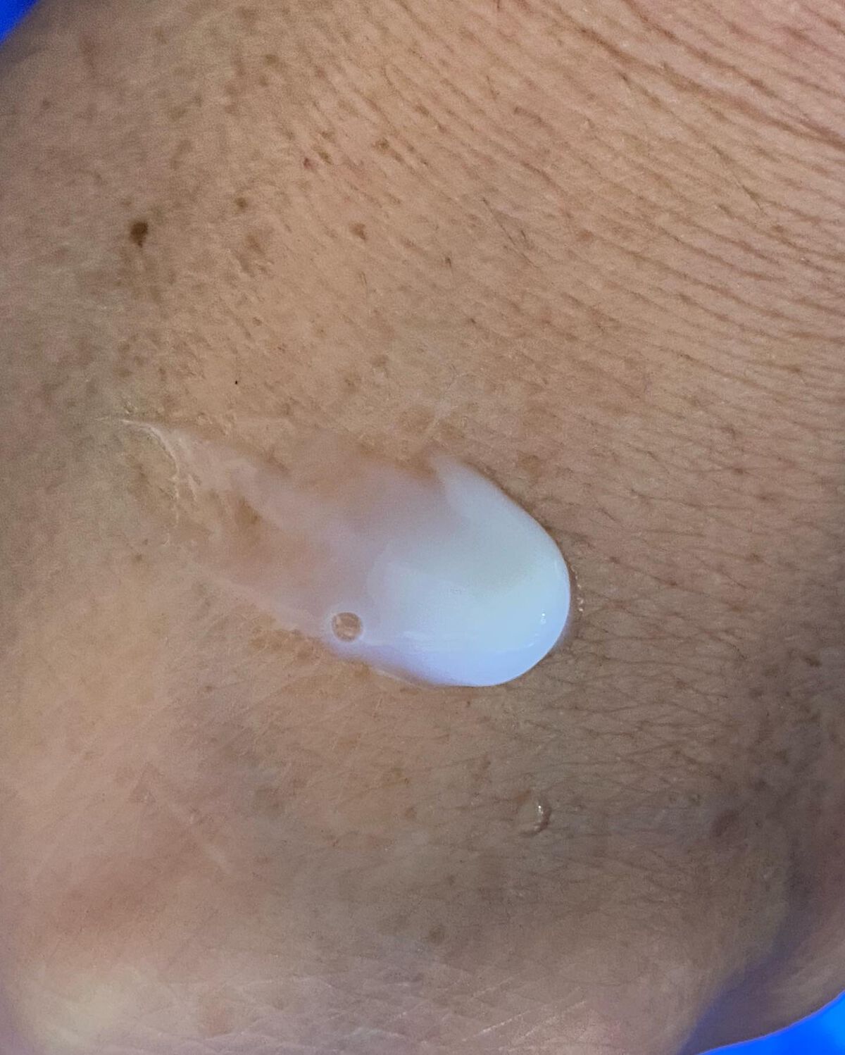 ヒアロワン/キユートピア/オールインワン化粧品を使ったクチコミ(6枚目)