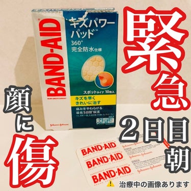 顔の傷にキズパワーパッドをあてた
翌朝の様子のレポートです。

＊＊＊＊＊＊♪＊＊＊＊♪＊＊
■バンドエイド キズパワーパッド
スポットタイプ

朝起きると傷のある部分が白く膨らんでいました。
ちょっと