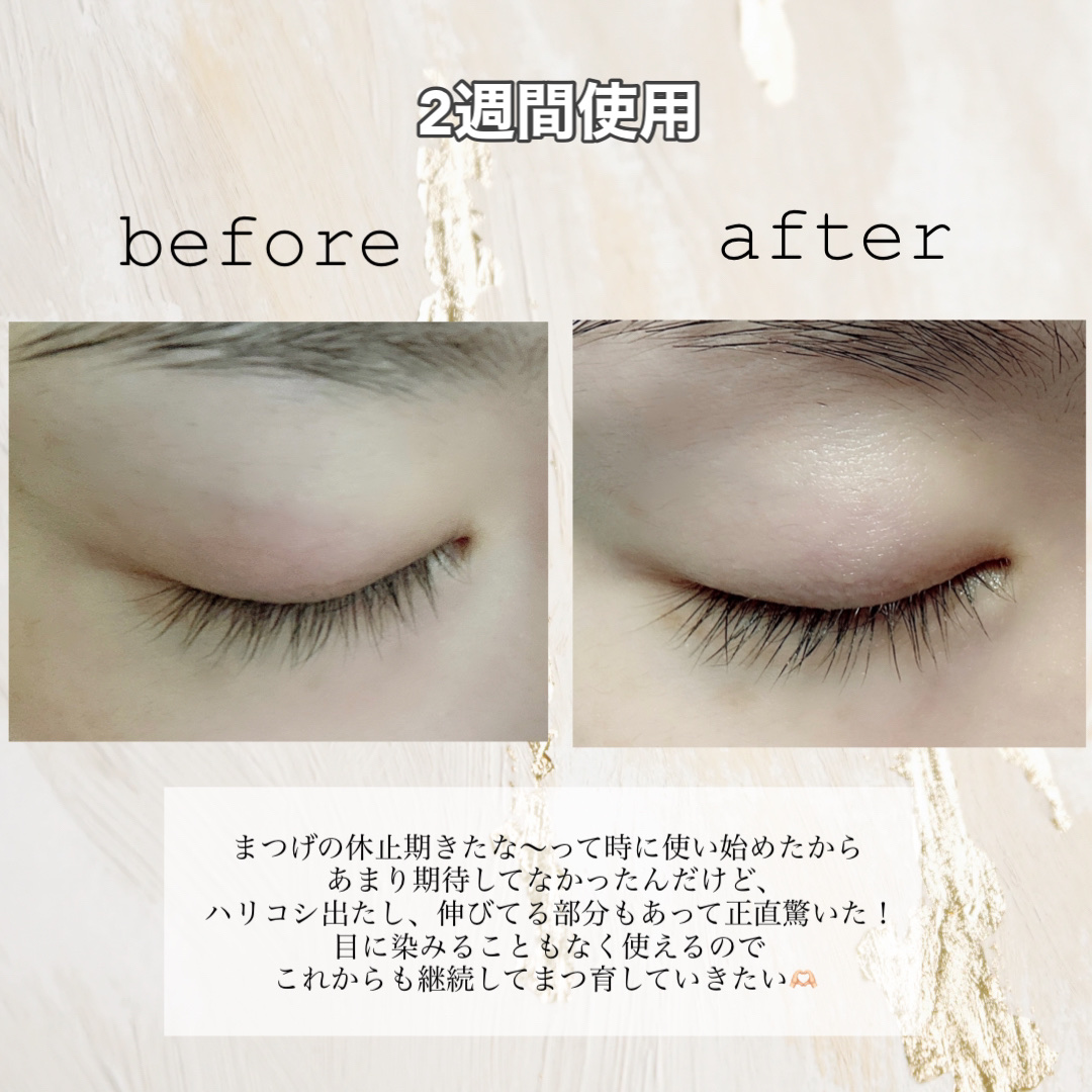 オールデイアイラッシュ デュアルセラム/daymellow’/まつげ美容液を使ったクチコミ（2枚目）