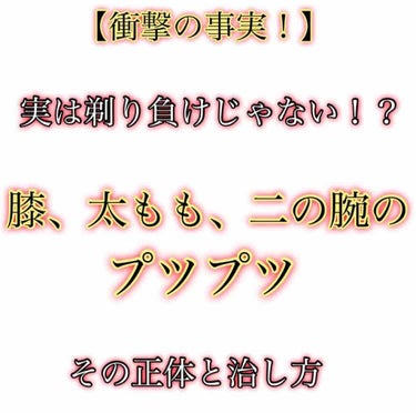 【衝撃の事実！実は剃り負けじゃなかった膝裏·二の腕のプツプツとその治し方】
皆さんこんにちはたかぎです！今回は膝裏と二の腕のプツプツについて、衝撃の事実😱😱

皆さん、プツプツわかりますか？そう、膝裏や