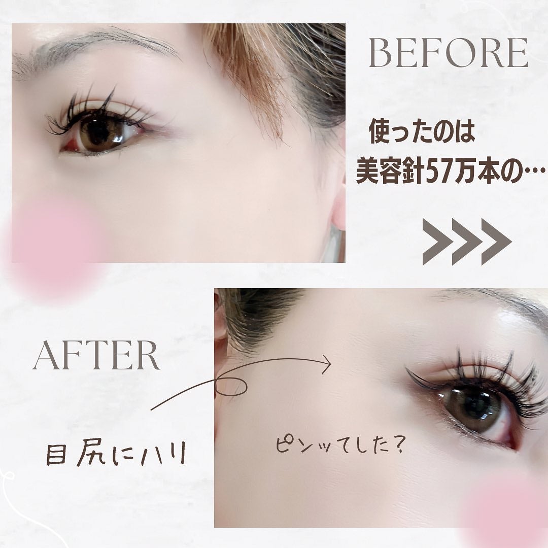 リードルショット700/VT/美容液を使ったクチコミ(2枚目)