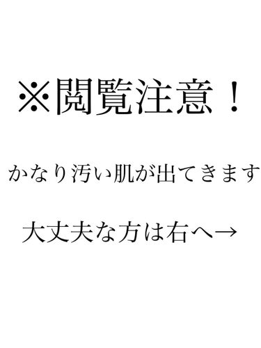 クレンジングオイルジェル/セルニュープラス/クレンジングジェルを使ったクチコミ（1枚目）