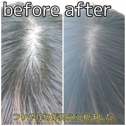 メディカルスカルプスパエッセンス/ティアレラプラス/頭皮ローションを使ったクチコミ(6枚目)