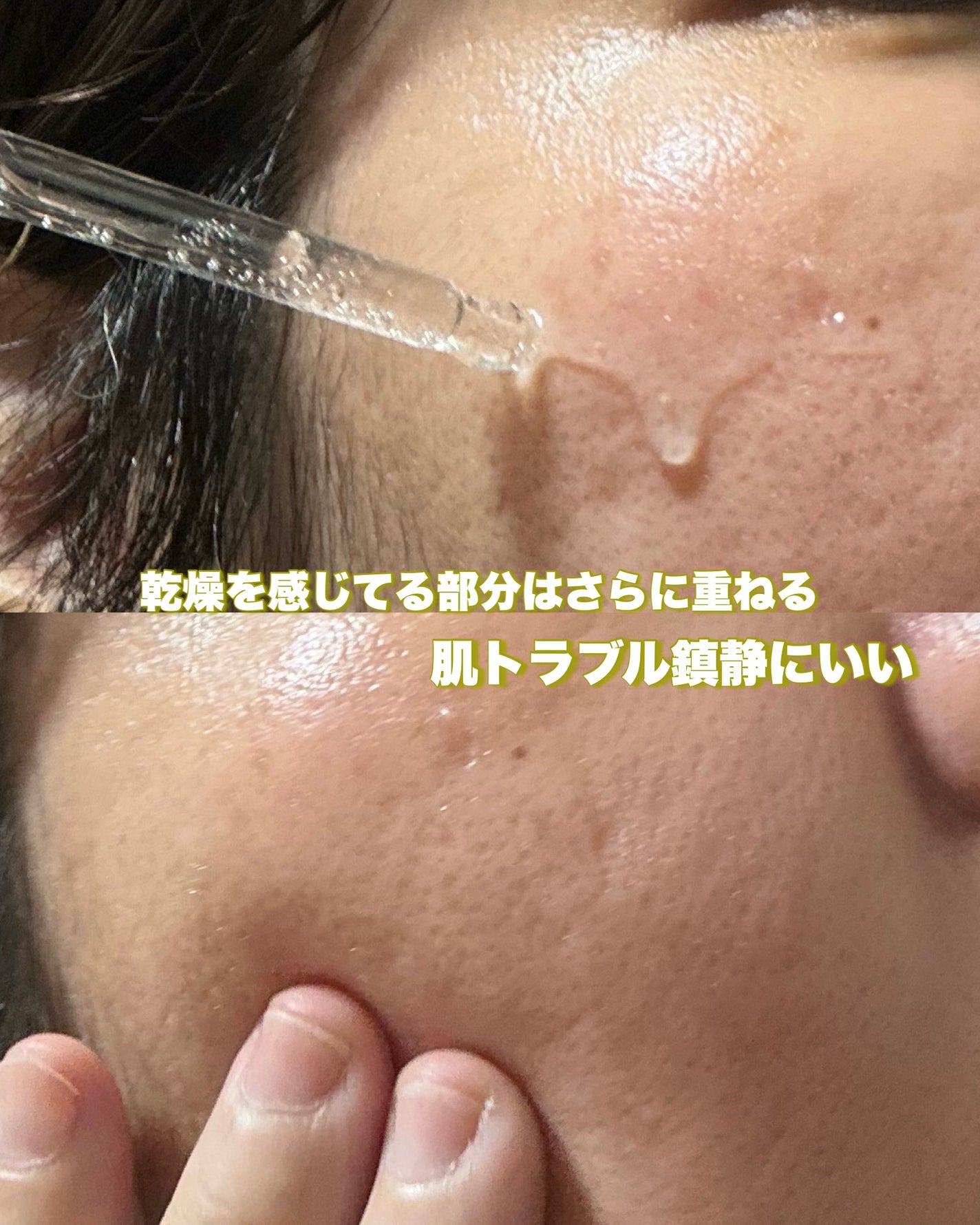 ノスカナイン トラブル セラム/FATION/美容液を使ったクチコミ(3枚目)