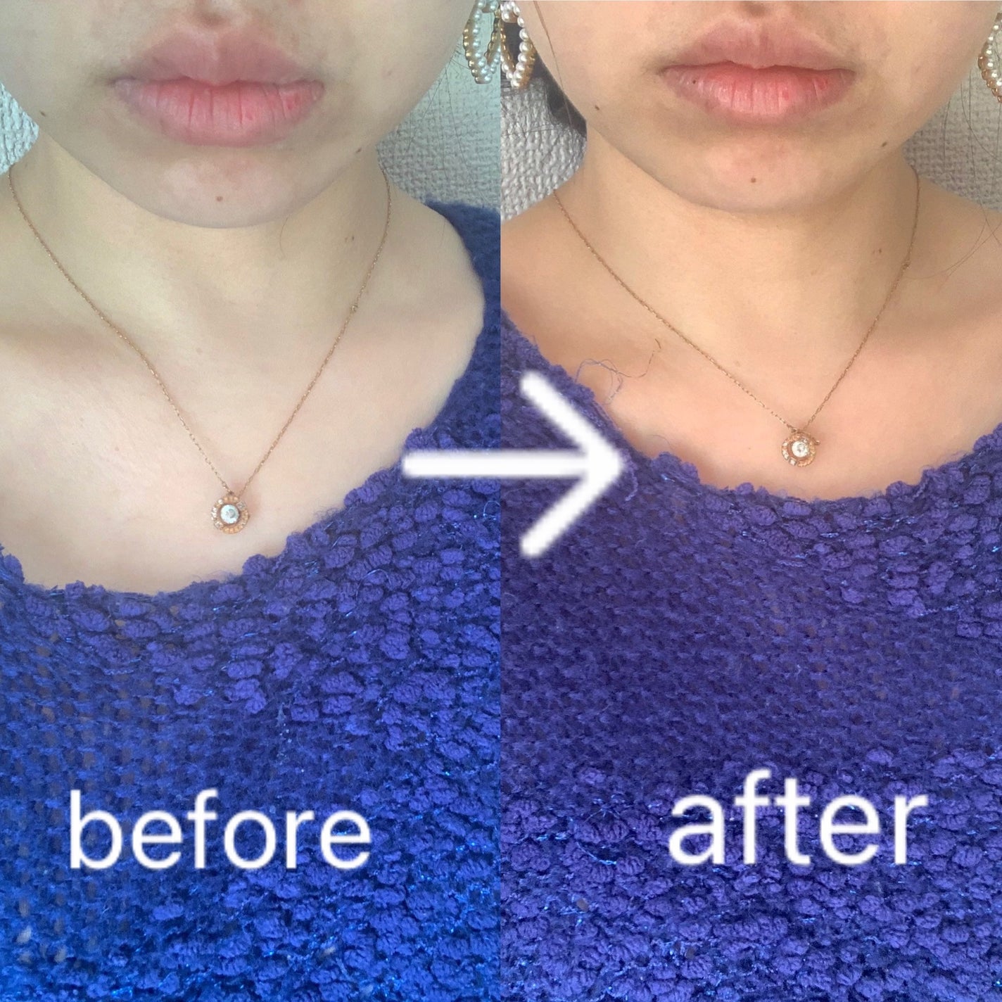 KogaO+/FancrN Pharmacy./シートマスク・パックを使ったクチコミ(4枚目)