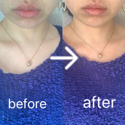 KogaO+/FancrN Pharmacy./シートマスク・パックを使ったクチコミ(4枚目)