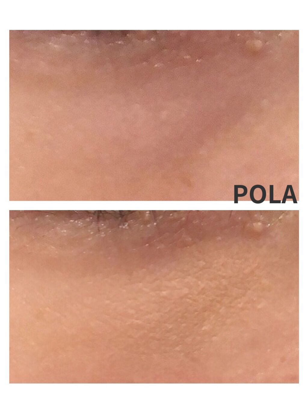 【旧】ディオールスキン フォーエヴァー スキン コレクト コンシーラー/Dior/リキッドコンシーラーを使ったクチコミ（2枚目）