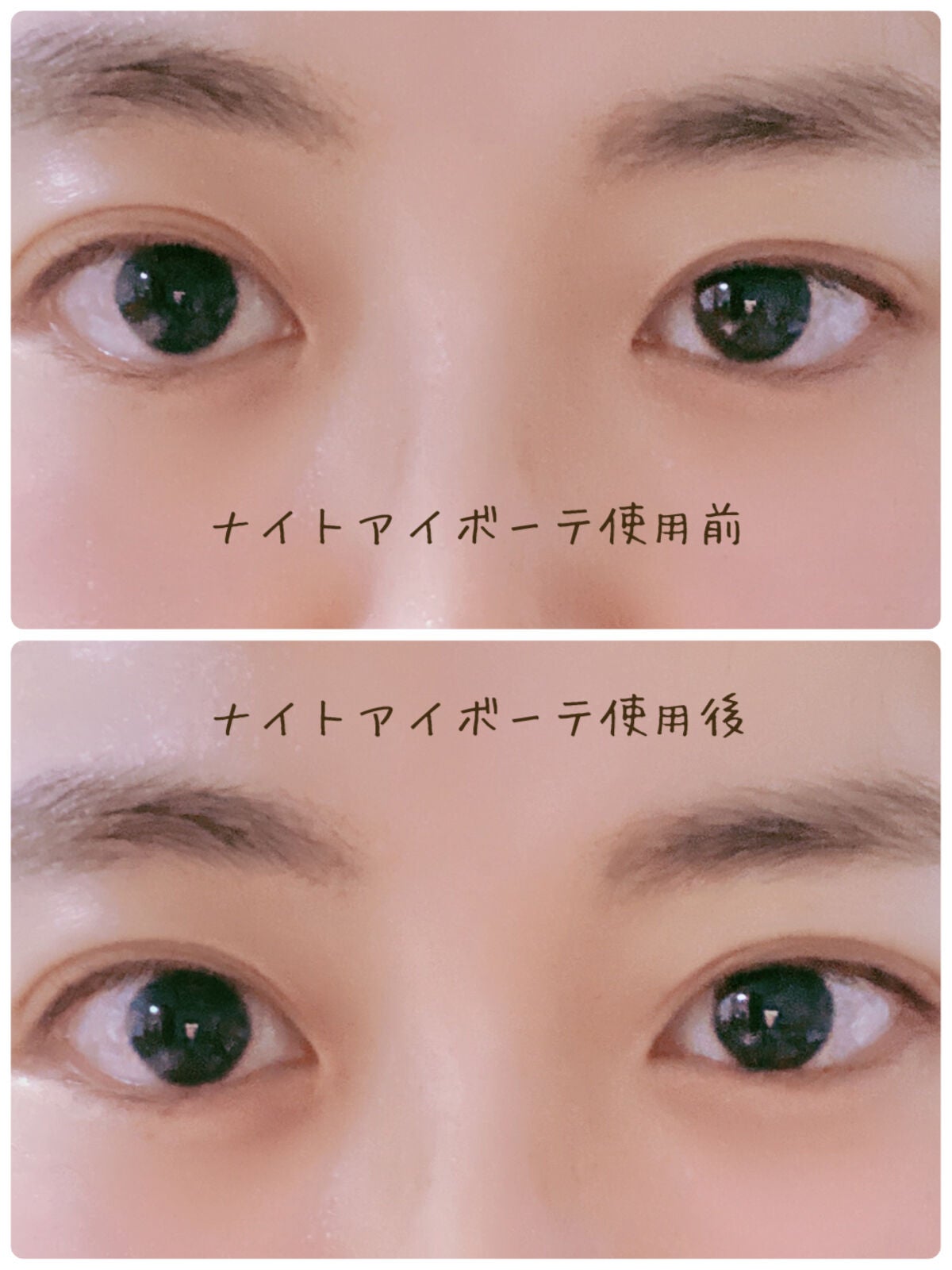ナイトアイボーテ/StreeTrend/二重まぶた用アイテムを使ったクチコミ(3枚目)