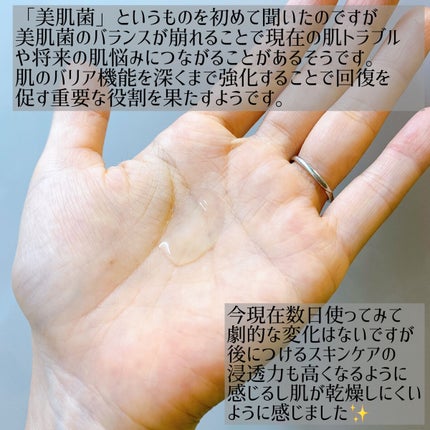 ãžã§ããã£ã㯠ã¢ããã³ã¹ã N/LANCOME/çŸå®¹æ¶²ã䜿ã£ãã¯ãã³ãïŒ3æç®ïŒ