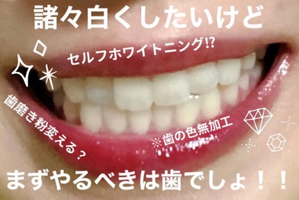 プロポリンス/プロポリンス/マウスウォッシュ・スプレーを使ったクチコミ(1枚目)