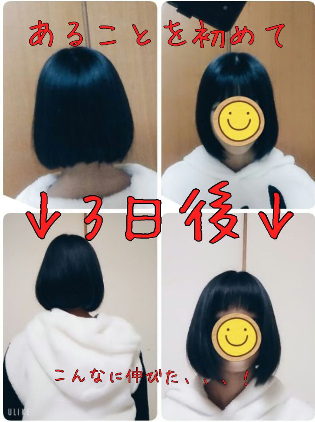 亜鉛 30日分 栄養機能食品 亜鉛 Dhcを使った口コミ やほー こんばんわm Mあの これ By ｱｿｳ 乾燥肌 Lips