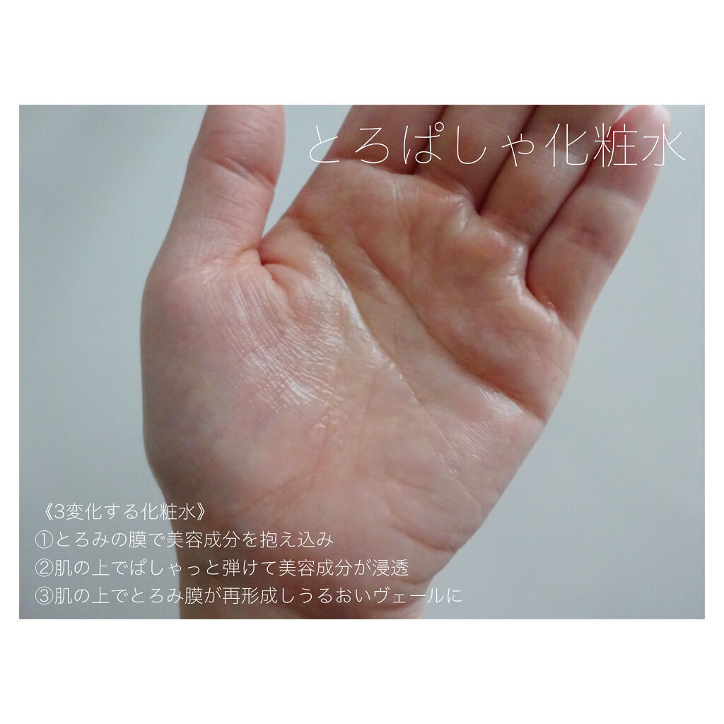 オルビスユー ローション/オルビス/化粧水を使ったクチコミ（2枚目）