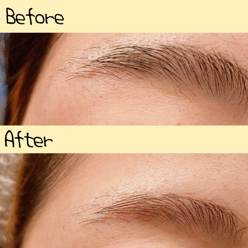 ジョレン クリーム ブリーチ/ジョレンジャパン/ムダ毛ケアを使ったクチコミ（2枚目）