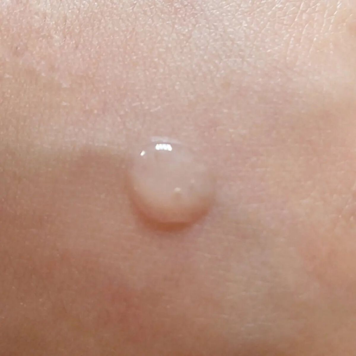 ファーストセラム/Rosemiu/美容液を使ったクチコミ（3枚目）