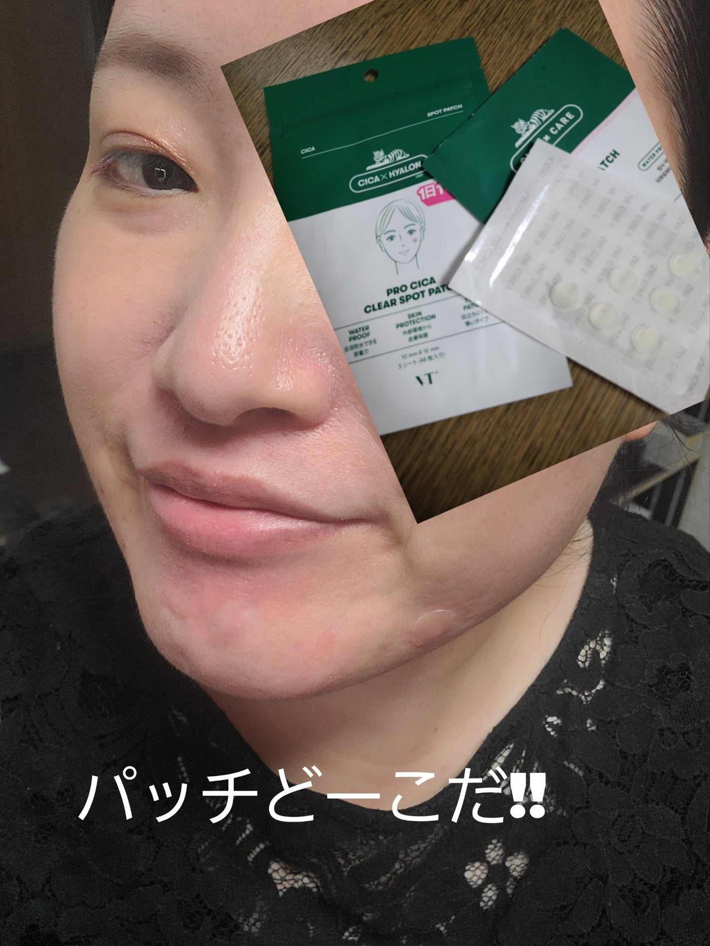 プロCICA クリアスポットパッチ/VT/その他スキンケアを使ったクチコミ(1枚目)