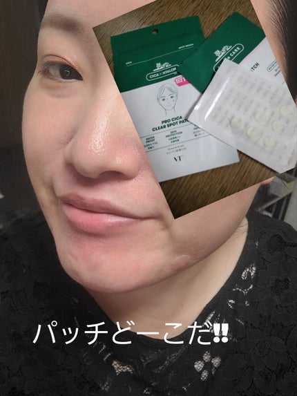 プロCICA クリアスポットパッチ/VT/その他スキンケアを使ったクチコミ(1枚目)