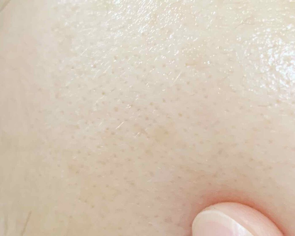 美肌養液 I’m PINCH/I'm PINCH/美容液を使ったクチコミ(4枚目)