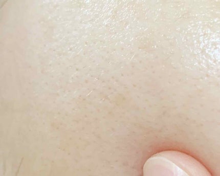 美肌養液 I’m PINCH/I'm PINCH/美容液を使ったクチコミ(4枚目)