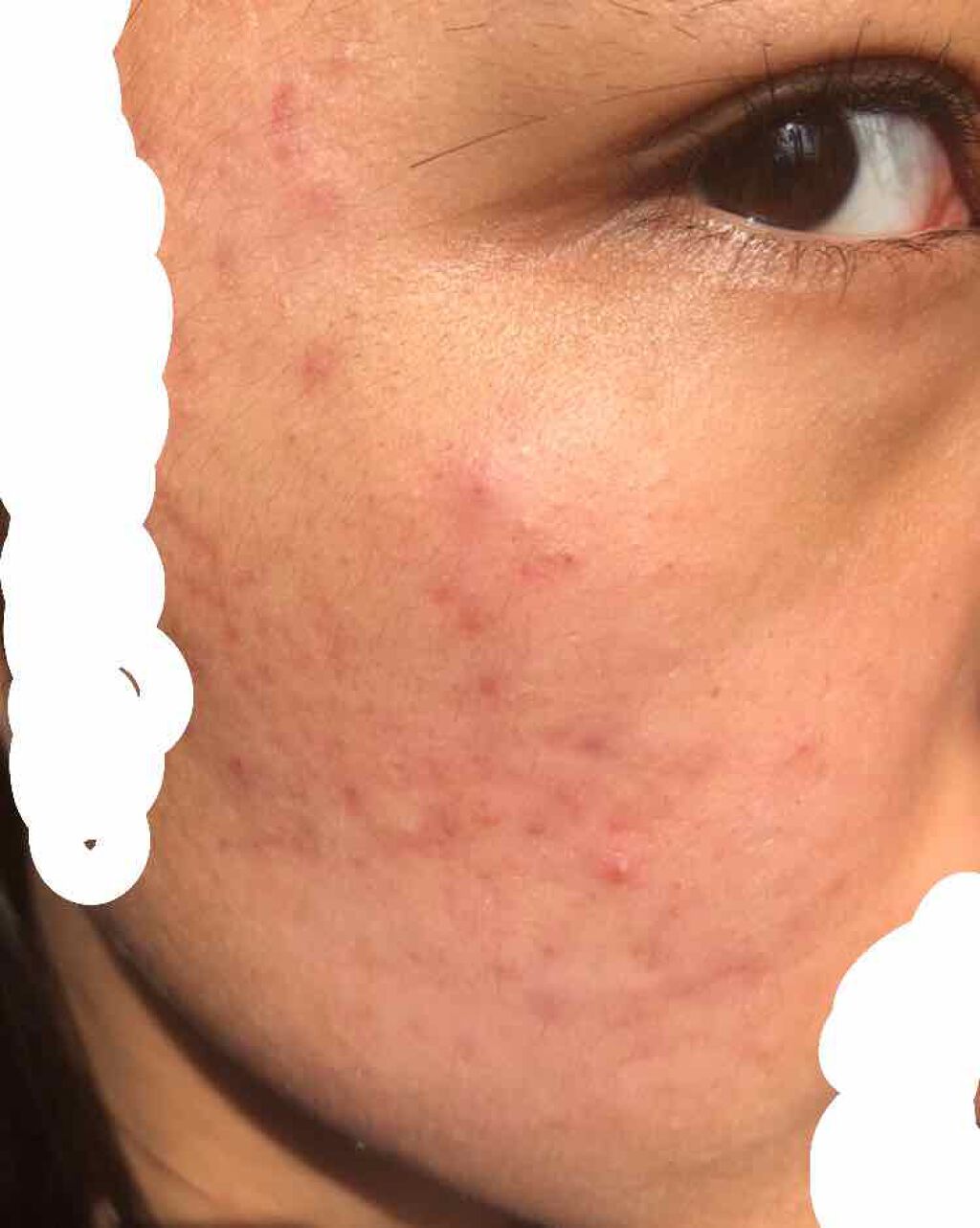 マスキング レイアリング アンプル エクセルトーニングショット/MEDIHEAL/美容液を使ったクチコミ（2枚目）