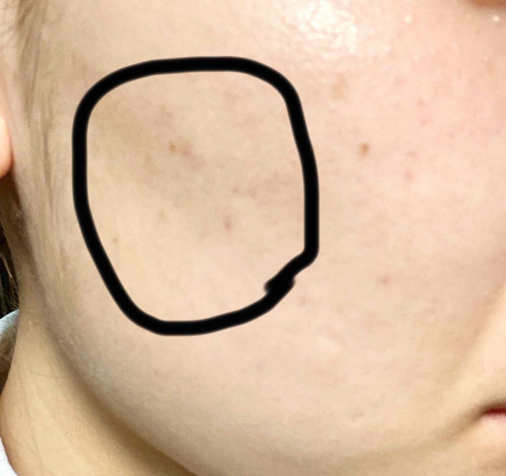 TOTA-S 3.0/CHICAY CHICO/フェイスクリームを使ったクチコミ(3枚目)