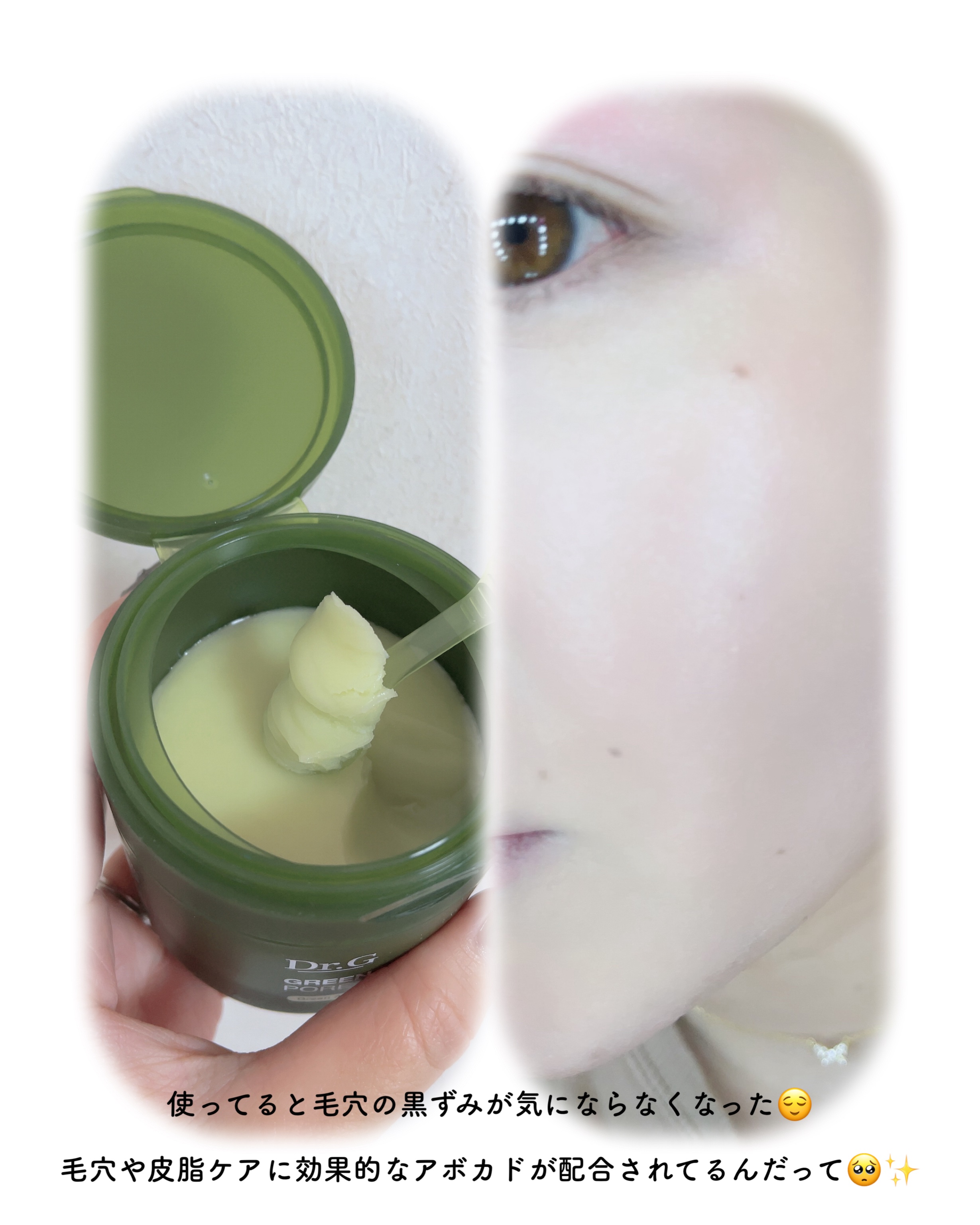 グリーンディープポアクレンジングバーム/Dr.G/クレンジングバームを使ったクチコミ（3枚目）