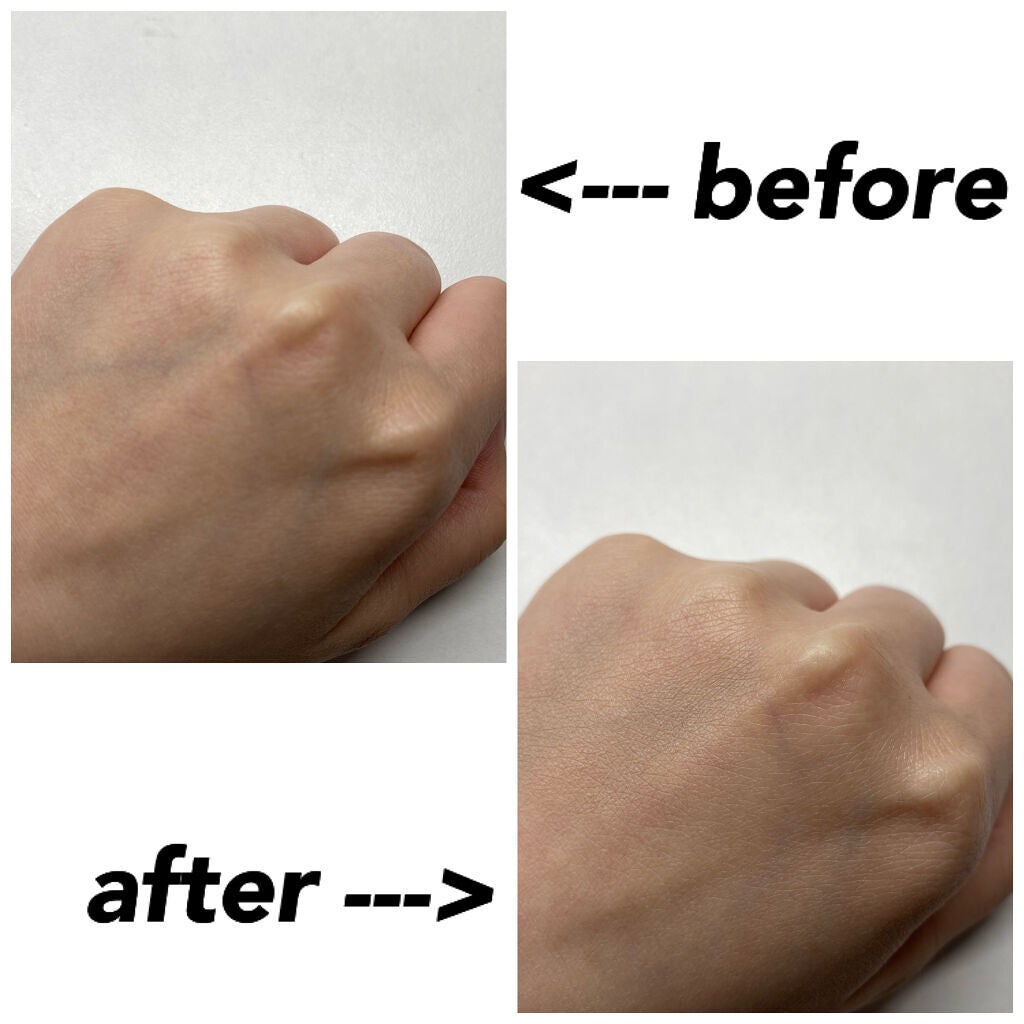 【旧】ディオールスキン フォーエヴァー スキン コレクト コンシーラー/Dior/リキッドコンシーラーを使ったクチコミ(2枚目)