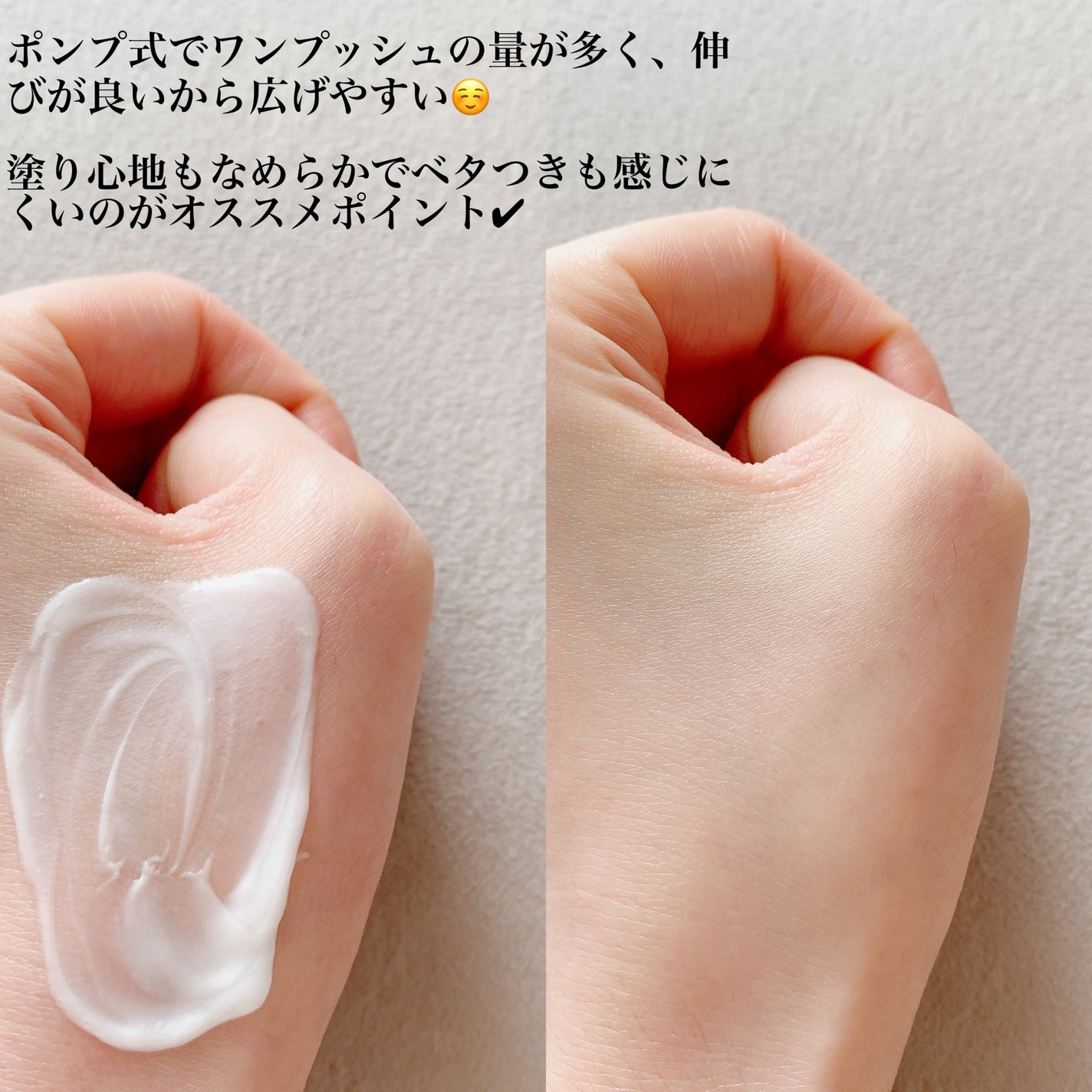 ã¡ãã£ã±ã€ãã£ãã ã»ã³ã·ãã£ãã±ã¢ ããã£ããŒã·ã§ã³ çŸèã±ã¢ãå»è¬éšå€åã/ãŽã¡ã»ãªã³/ããã£ããŒã·ã§ã³ã䜿ã£ãã¯ãã³ãïŒ2æç®ïŒ