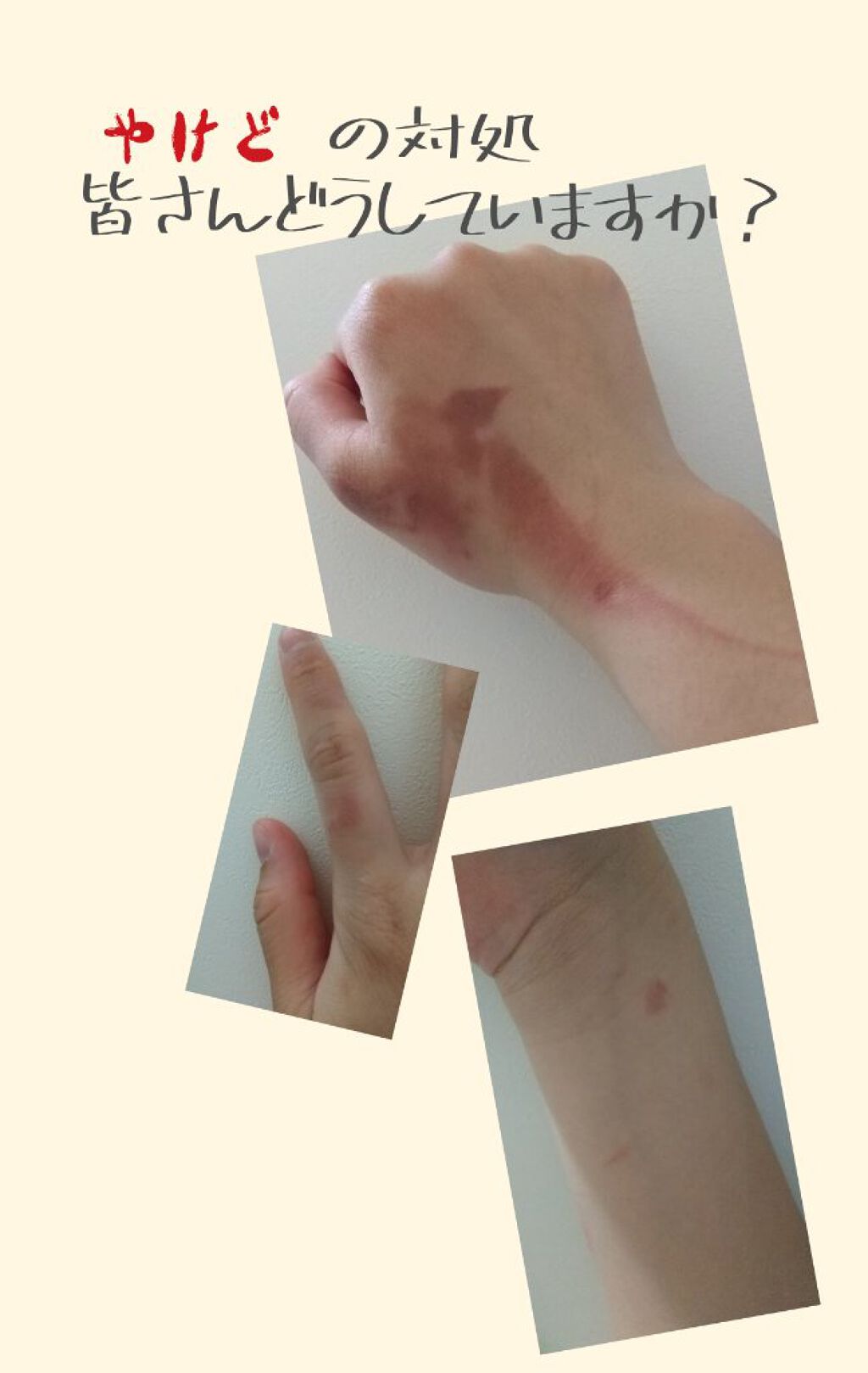 yumetamago on LIPS 「こんにちは!写真が少しグロくて申し訳ないですm(*__)m今回..」(1枚目)