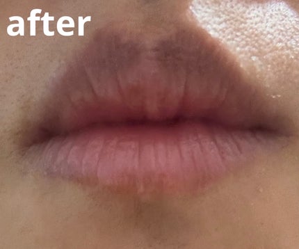 ã¬ãããŒã« ããªã¥ãŒã ãªããã»ã©ã /primera/ãªããã°ãã¹ã䜿ã£ãã¯ãã³ãïŒ5æç®ïŒ