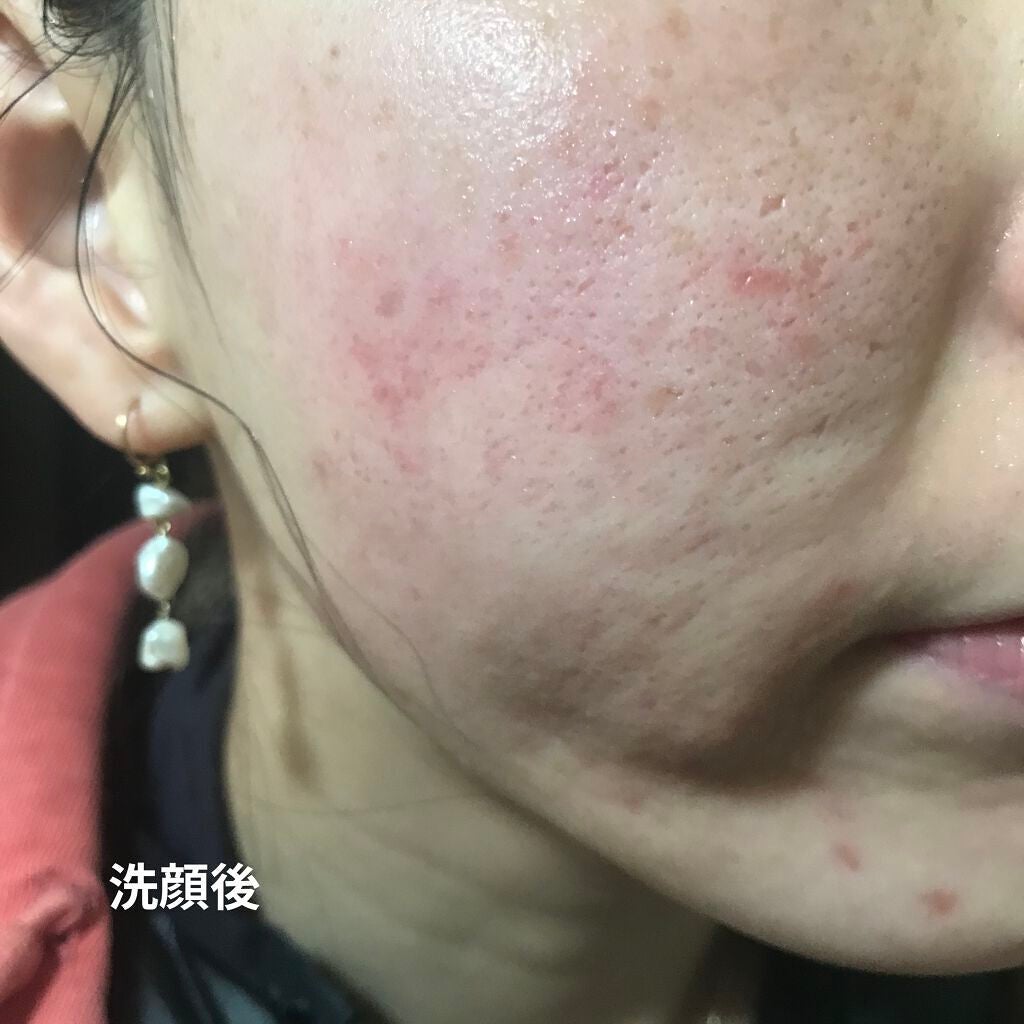 ライトリフレクティングセッティングパウダー プレスト N/NARS/プレストパウダーを使ったクチコミ(6枚目)