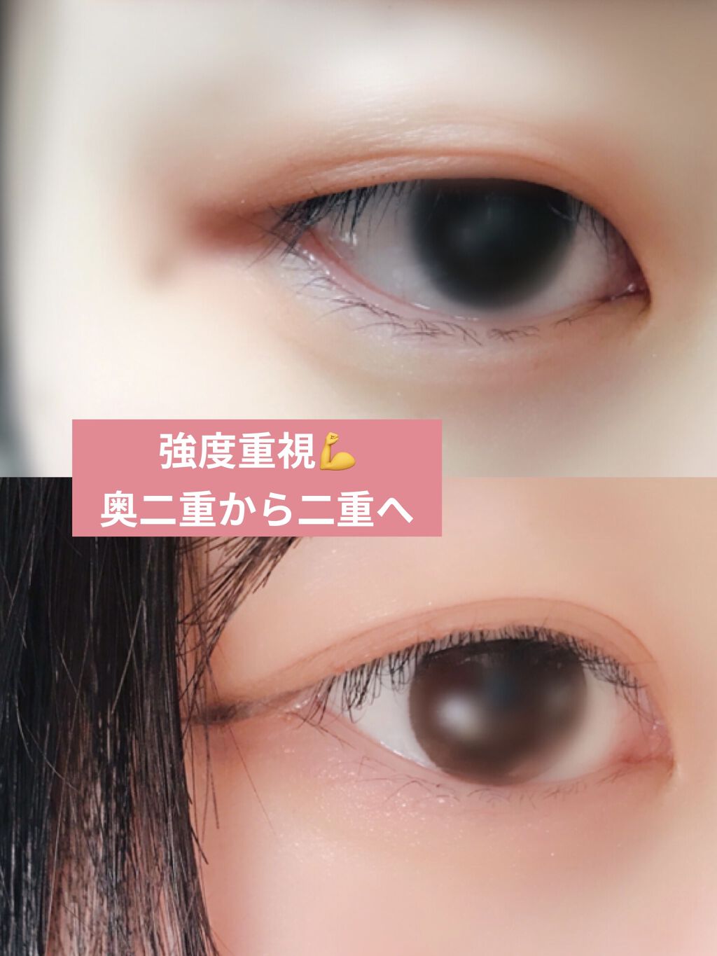 アイビューティー フィクサー WP/アストレア ヴィルゴ/二重まぶた用アイテムを使ったクチコミ（1枚目）