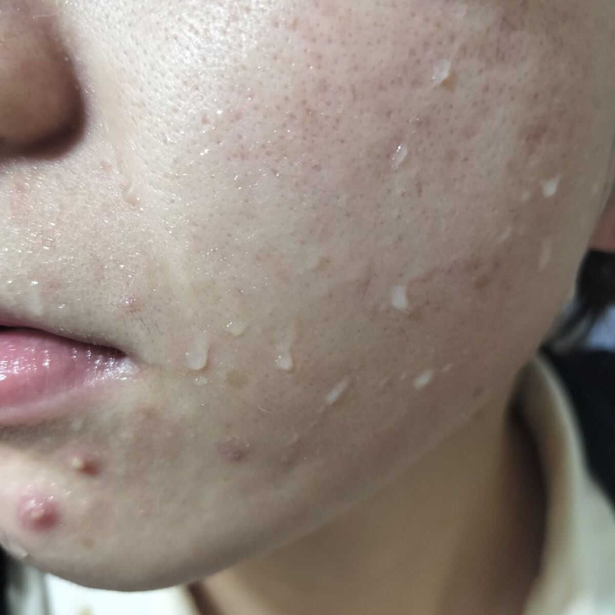 ハトムギ化粧水(ナチュリエ スキンコンディショナー R )/ナチュリエ/化粧水を使ったクチコミ(2枚目)