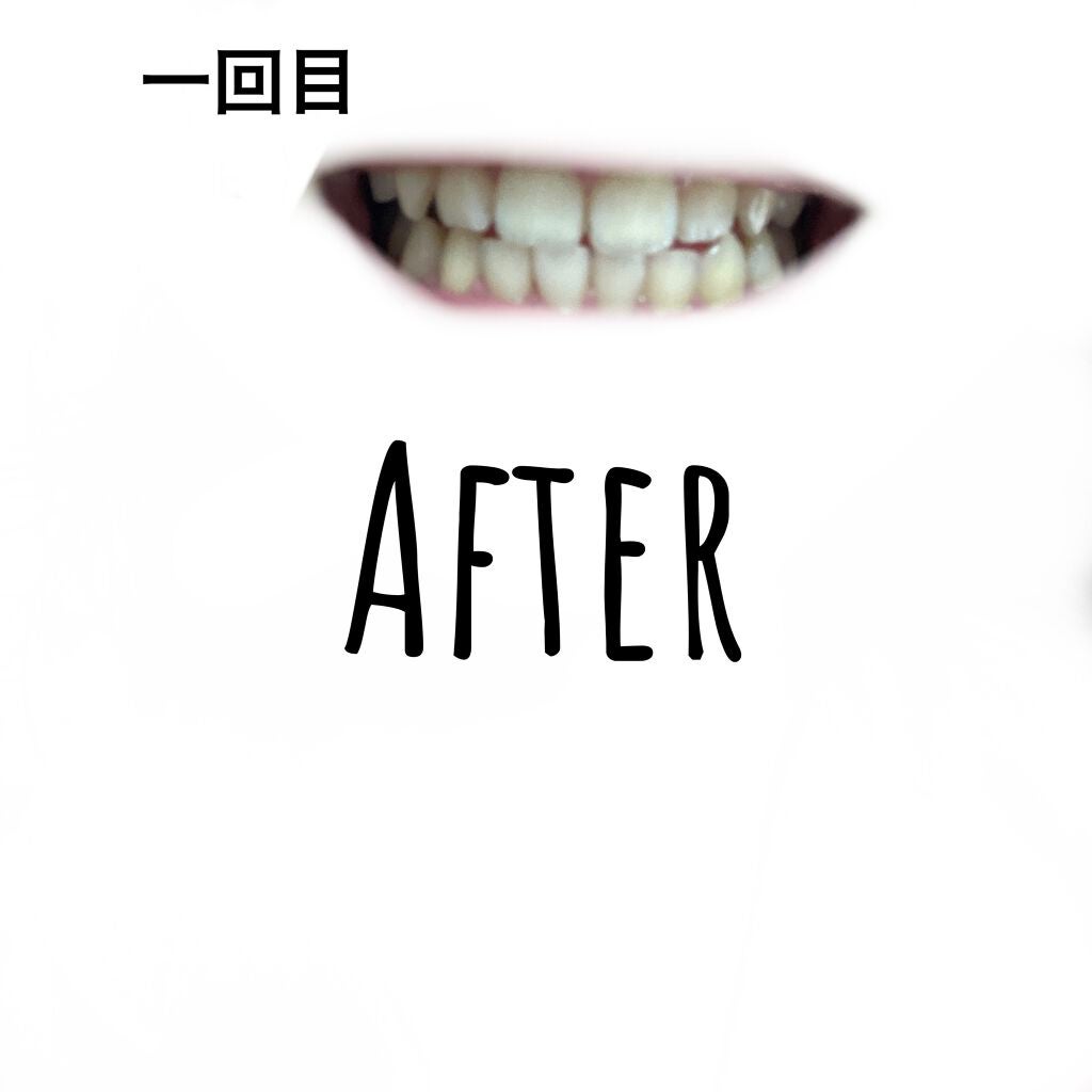 オーラツー プレミアム クレンジングペースト プレミアムミント/オーラツー/歯磨き粉を使ったクチコミ(3枚目)