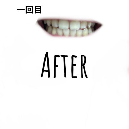 オーラツー プレミアム クレンジングペースト プレミアムミント/オーラツー/歯磨き粉を使ったクチコミ(3枚目)