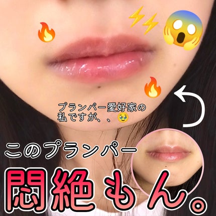 リードルS リッププランパーエキスパート/VT/リッププランパーを使ったクチコミ(2枚目)
