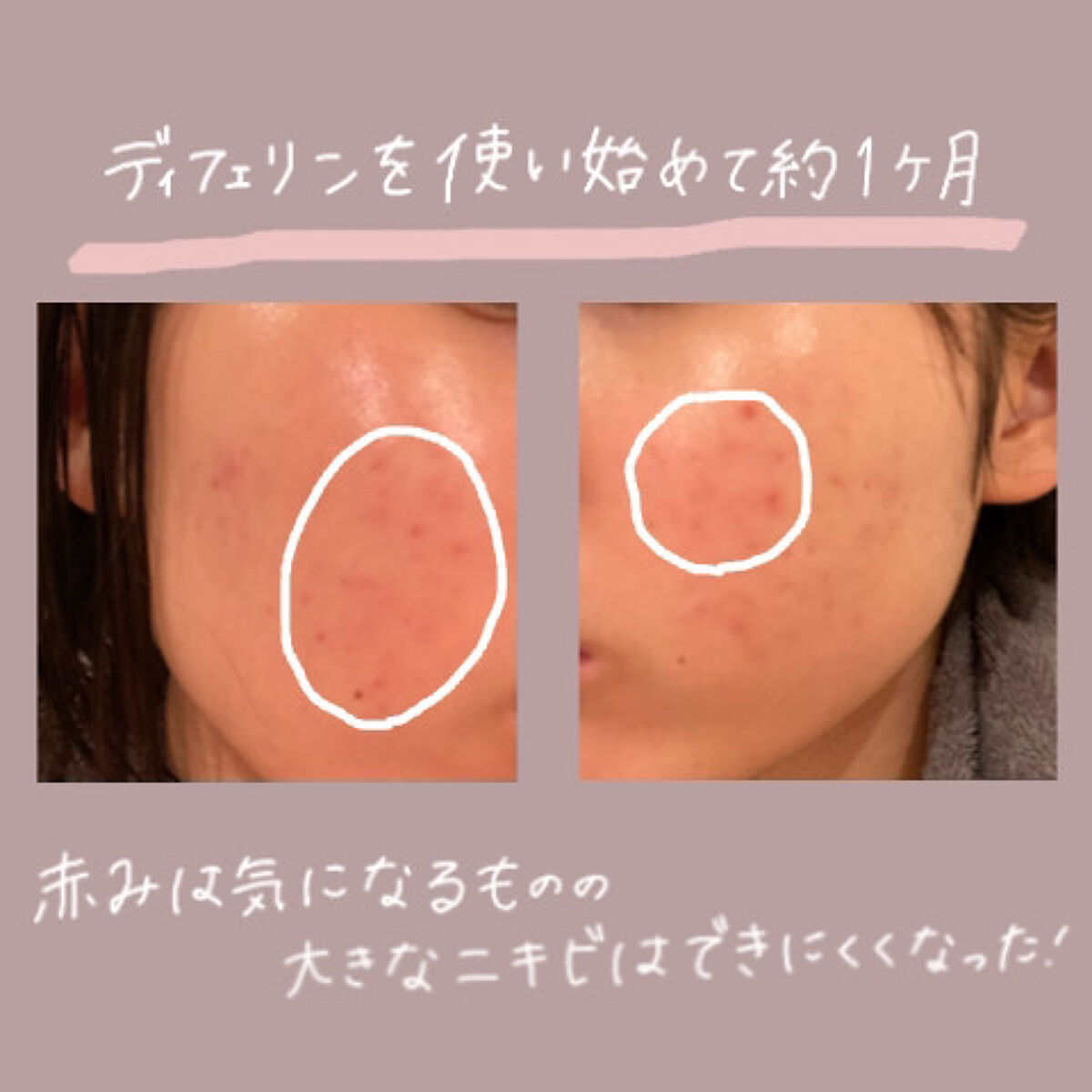 しっかりクリアジェル/ビオレ/クレンジングジェルを使ったクチコミ（3枚目）